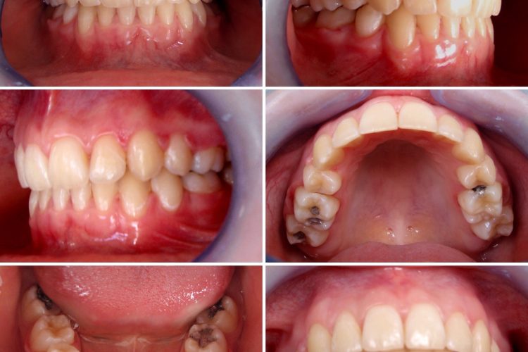 Ortodoncija